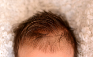 Read more about the article Why do babies lose hair as they grow?